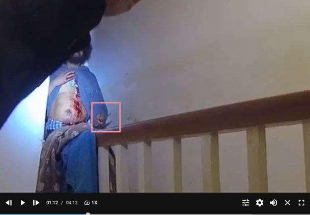 From Ptlm. Cannon’s BWC: Burton holding a knife in his left hand and holding his shirt up, showing his wounds.